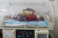 neonatal intensive care incubator