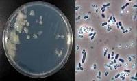 Azotobacter Bacteria