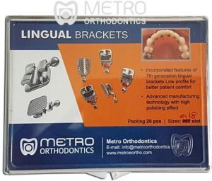 lingual brackets