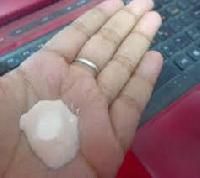 calamine lotion