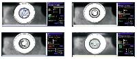 Vision Inspection System