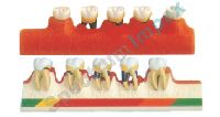 Periodontal Disease Model