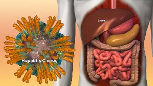 Hepatitis C Treatment