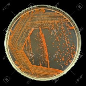 Sulphur & Iron Solubilizing Bacteria