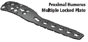 Proximal Upper Limb Plate