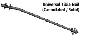 Universal Tibia Intramedullary Nailing System