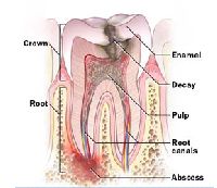 Root Canal File