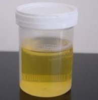 Distilled Cow Urine ark