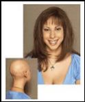 Cancer Patients Hair Wigs