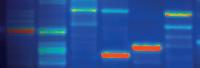 electrophoresis