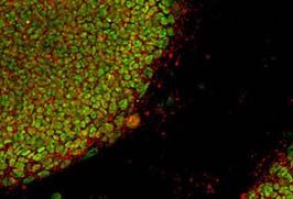 Pluripotent Stem Cells