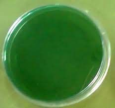 TCBS Agar Plate