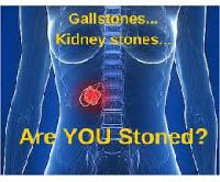 Kidney Gallbladder Stone
