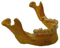 Artificial Mandible