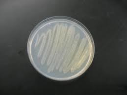 Azotobacter Biofertilizer