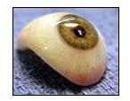 Ocular Prosthesis Fitting