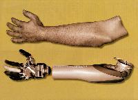 Artificial Limbs