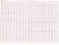 ecg papers