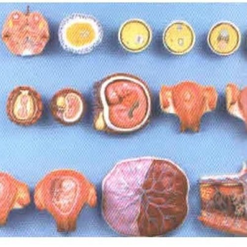 Human Fertilization Model
