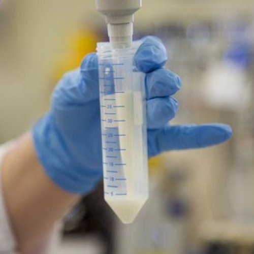 Milk Testing Services