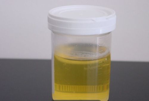 Donkey Urine