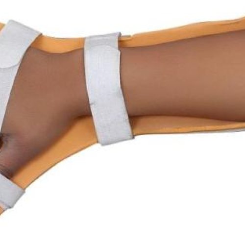 Cuck Up Splint Without Hole