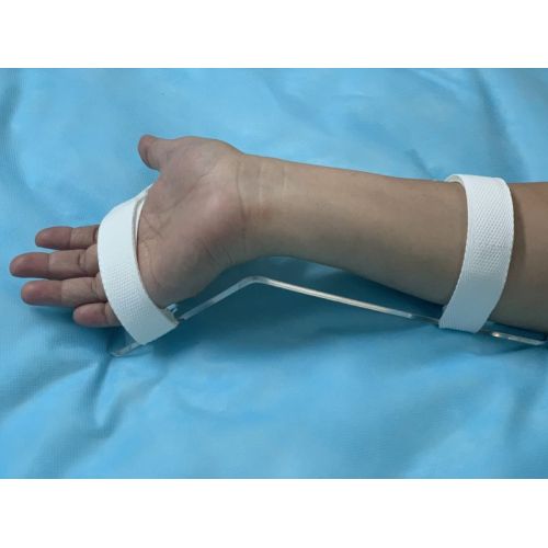 Splints