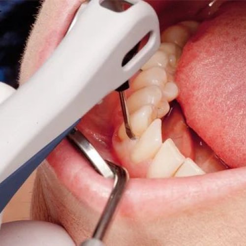 Dental Treatment Service