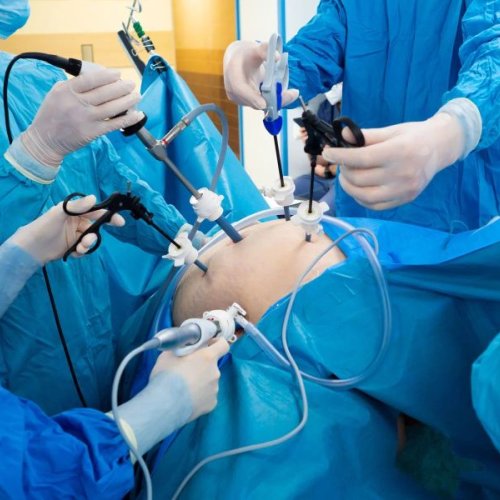 Kidney Transplantation Treatment Service