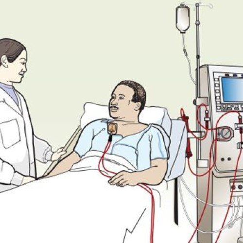 Dialysis Treatment Services