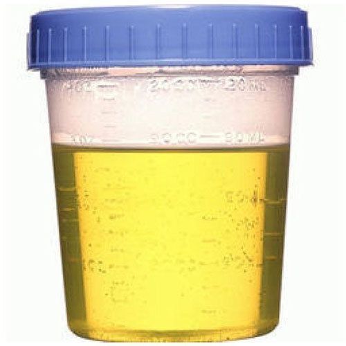 Donkey Urine