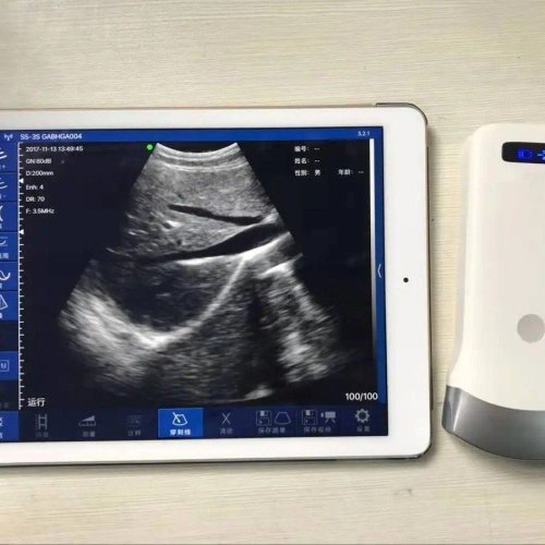 Wireless Ultrasound Scanner SY-A053CL