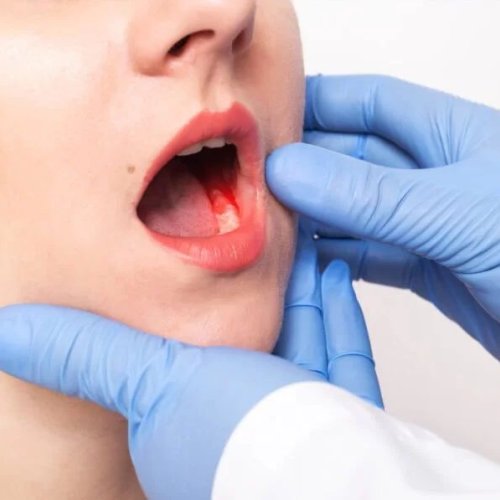Oral Cancer Treatment Service