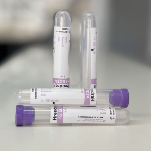 K2 EDTA Non Vacuum Blood Collection Tube