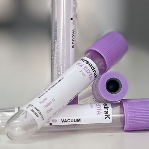 K2 EDTA Vacuum Blood Collection Tube