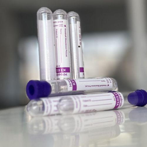 K3 EDTA Single Cap Non Vacuum Blood Collection Tube