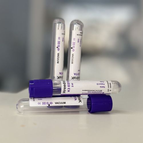 K3 EDTA Vacuum Blood Collection Tube