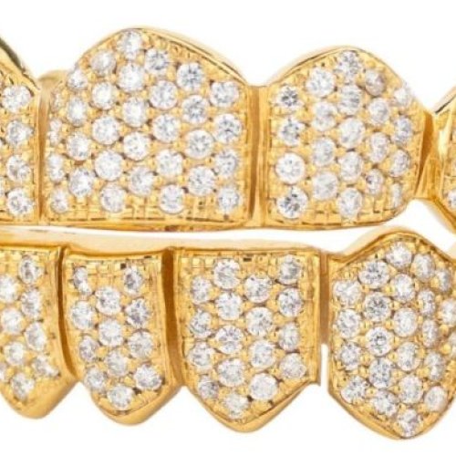 Men Gold Plated Sterling Silver Moissanite Diamond Grillz