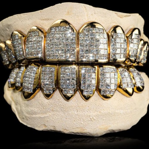 Sterling Silver Diamonds Hip Hop Iced Out Moissanite Diamond Grillz