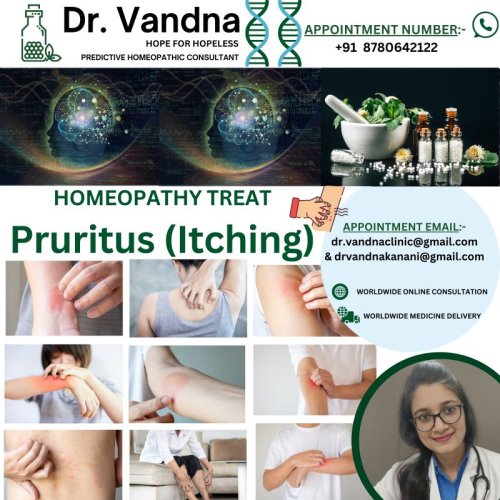 World Best Homeopathic Physicians Consultation For Skin Problem Pruritus