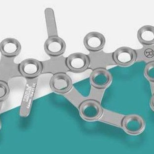 Calcaneal Locking Plate