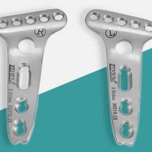 Locking Butress Plate