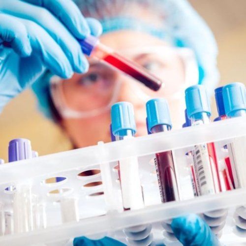 Acute Avian Toxicity Test