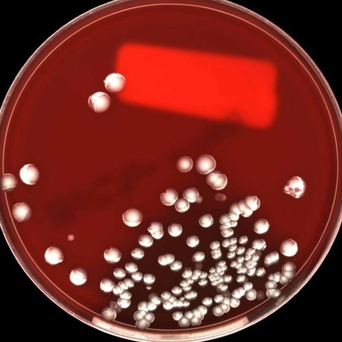 Aerobic Microbial Culture