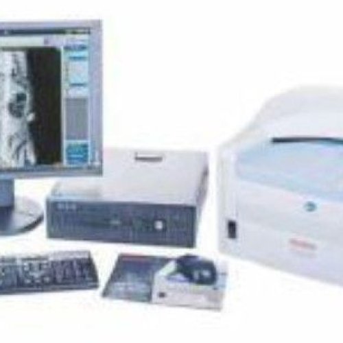 Digital Computed Radiography Imaging System