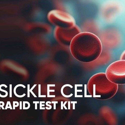 Sickle Cell Rapid Test Kit Sickle Cell Rapid Test Kit