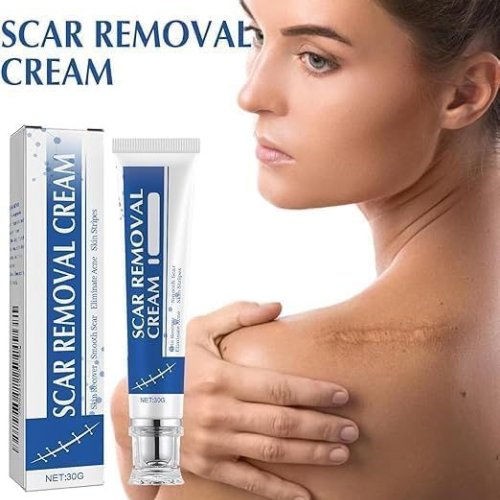 Scar Removal Cream