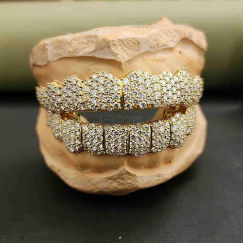 Diamond Grillz Set