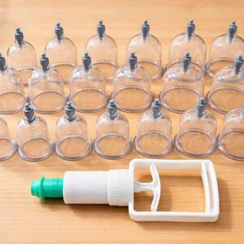 Blood Circulation Cupping Therapy Service