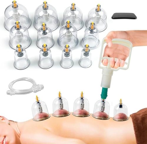 Deep Tissue Cupping Therapy Service